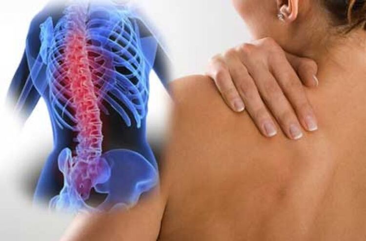 During an exacerbation of osteochondrosis of the thoracic spine, dorsal pain occurs