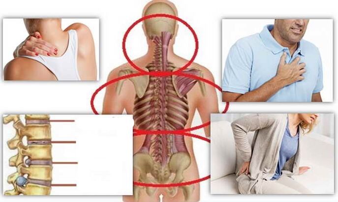 Place of disease for osteochondrosis