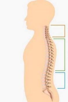osteochondrosis lesions from various parts of the spine