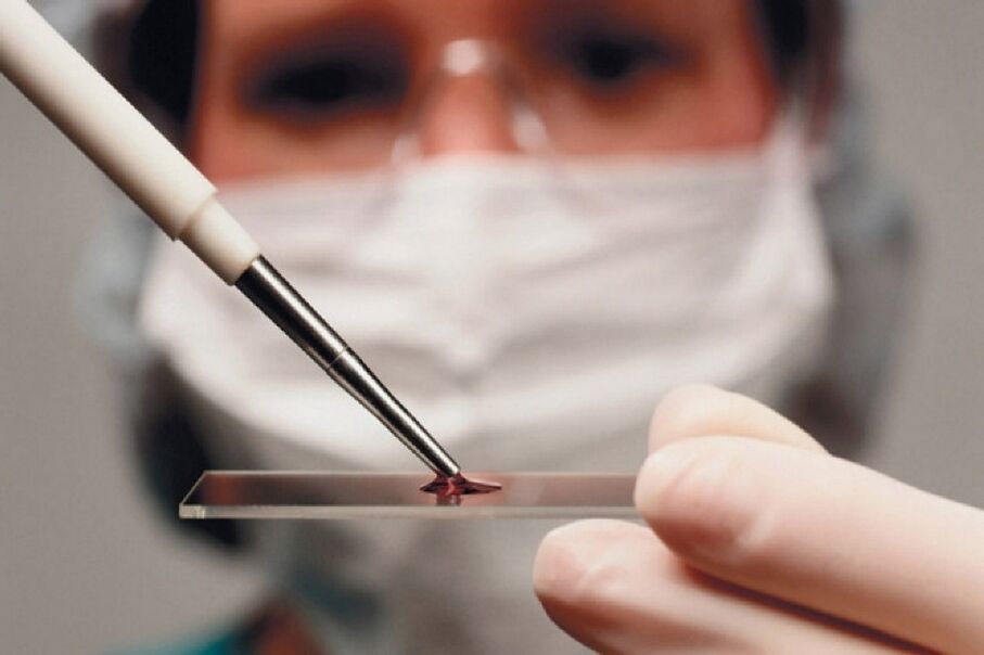 Arthritis is an inflammatory disease, and its presence is known through blood tests.